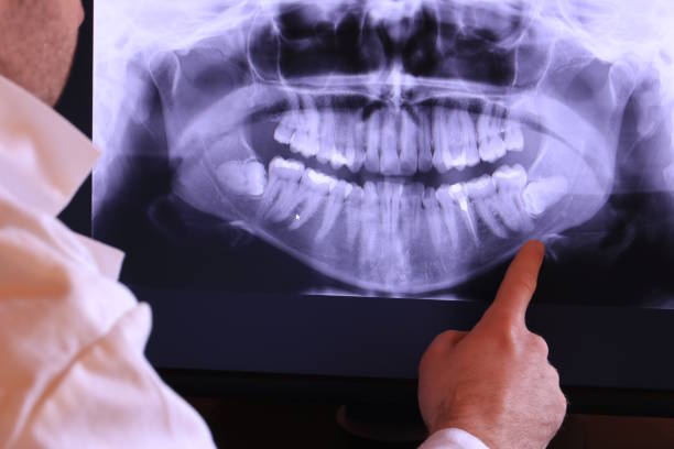 Best Emergency Dental Care for Trauma or Injury in Crystal City, MO